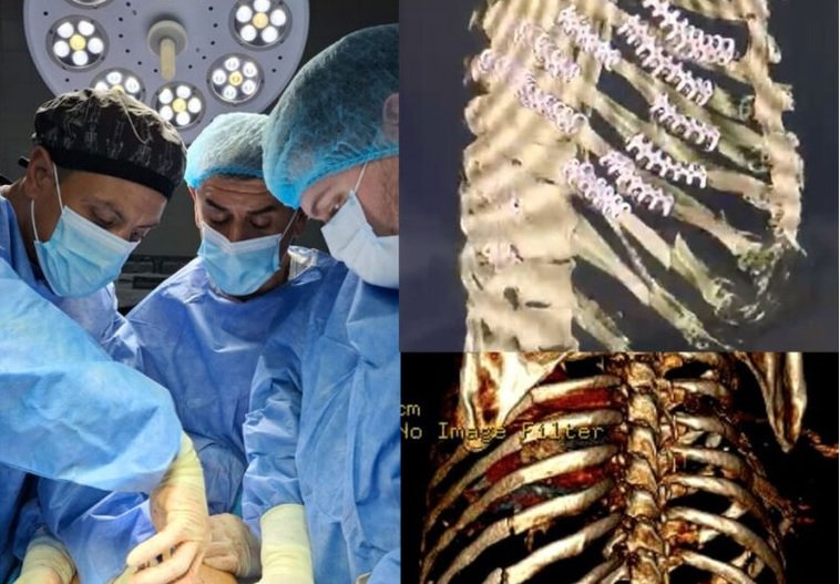 Cirugía inédita integrada por un médico oriundo de San Salvador.