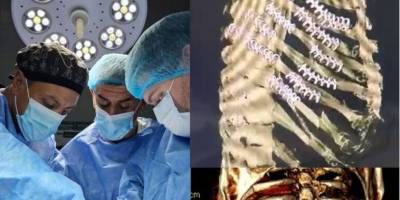 Cirugía inédita integrada por un médico oriundo de San Salvador.